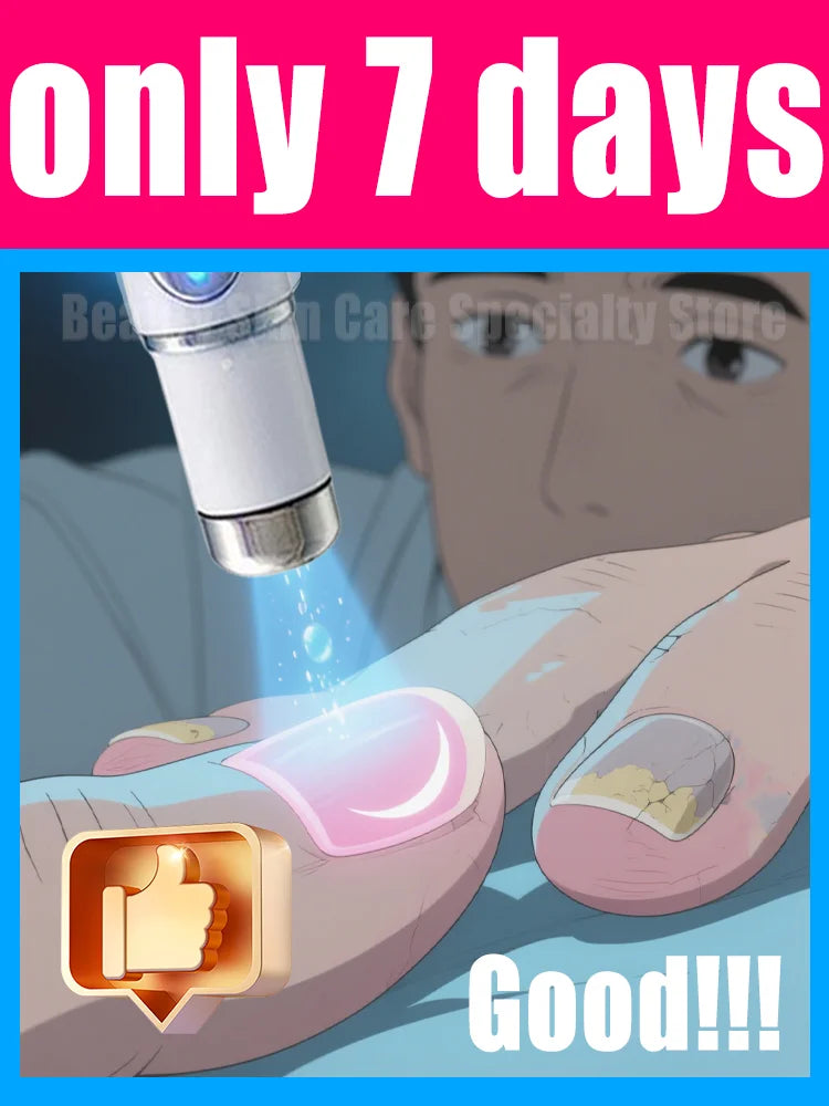 2025 Nail Cleaning Tools – 2nd Gen Blue Light Laser for Root Repair & Nail Care
