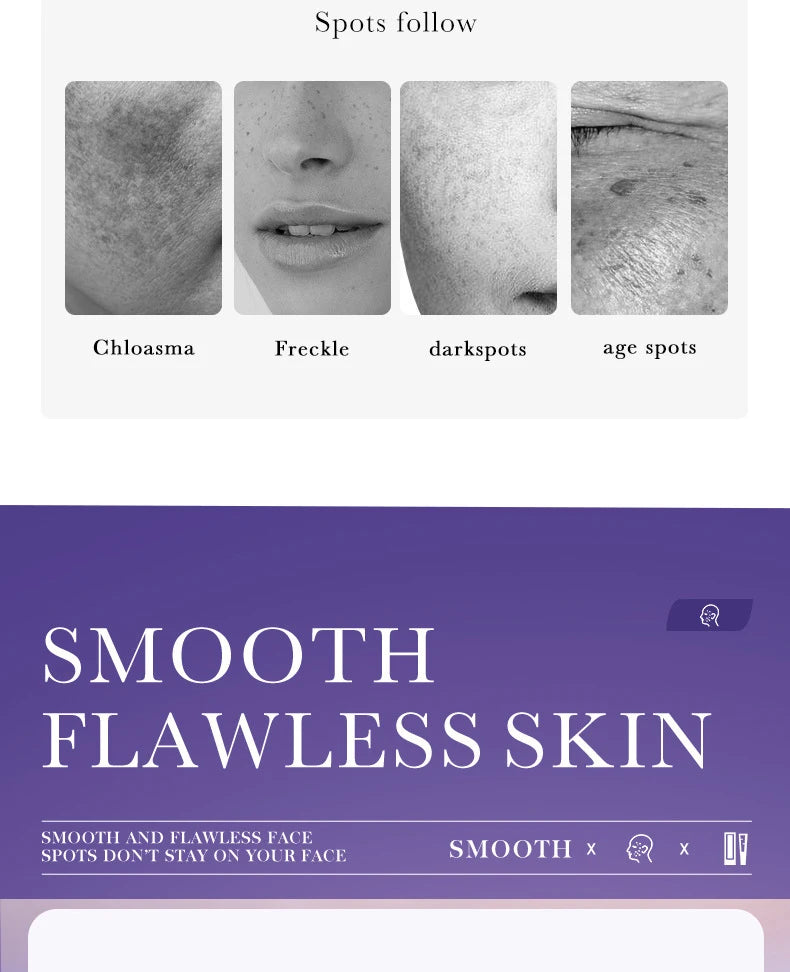 SADOER Freckle Removing Cream — Nicotinamide Moisturizing Face Cream for Hydrating, Nourishing & Firming Skin