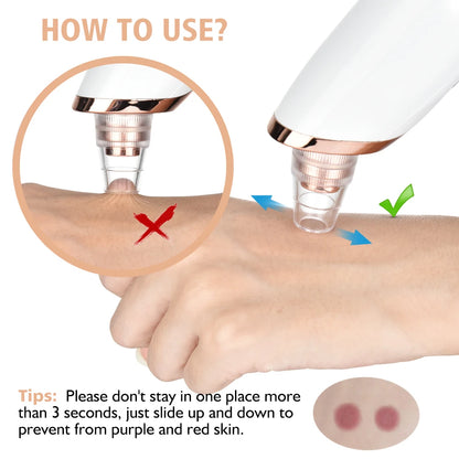 3-Mode Blackhead Remover Vacuum – Facial Pore Cleaner & Dead Skin Removal Beauty Tool