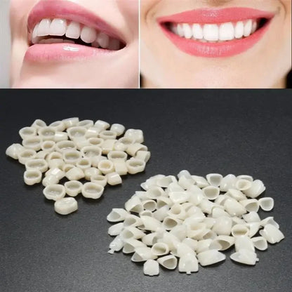 60pcs Resin Teeth Dentistry – Temporary Crown Material for Anterior & Molar Teeth, Oral Care Protection, Whitening & Stability