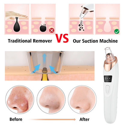 3-Mode Blackhead Remover Vacuum – Facial Pore Cleaner & Dead Skin Removal Beauty Tool