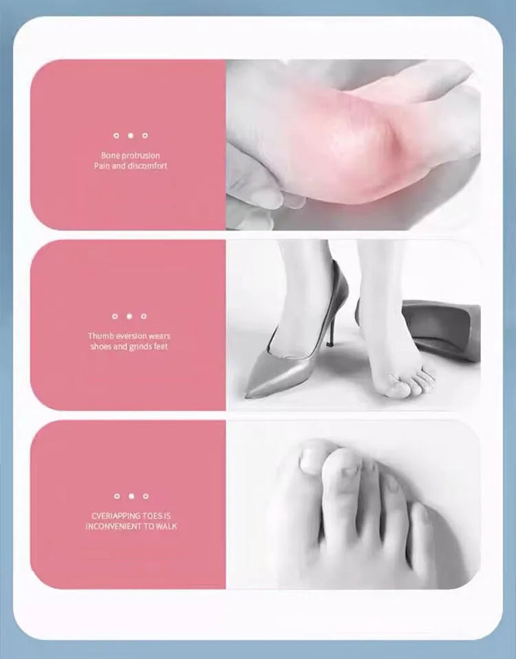 2Pc Silicone Toe Separator — Foot & Toe Spreader for Hallux Valgus, Bunion Correction & Toe Straightening