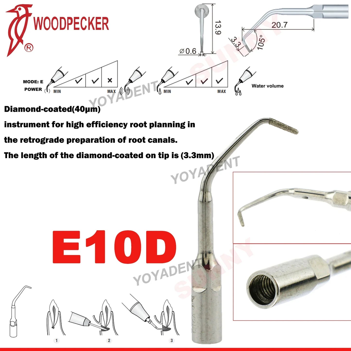 Woodpecker Dental Scaler Tips – Ultrasonic Tooth Cleaning, Endo & Perio Scaling Tips, Fit EMS UDS Scaler Handpiece