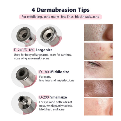 Foreverlily Portable Diamond Peeling Machine – Microdermabrasion Facial Cleaner & Blackhead Remover Vacuum Device