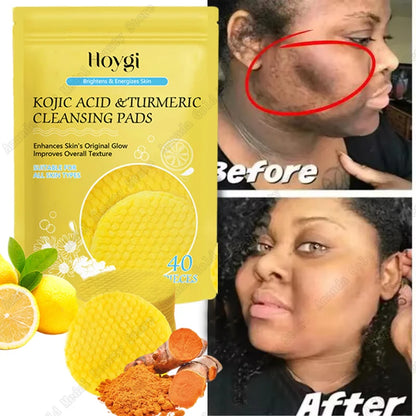 Turmeric & Kojic Acid Facial Cleansing Pads — Lemon Deep Cleanse, Brightening & Whitening Cotton Pads for Face Skincare