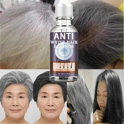 White Hair Remover – Restore Natural Hair Color in 7 Days, Gray Hair Treatment Solution