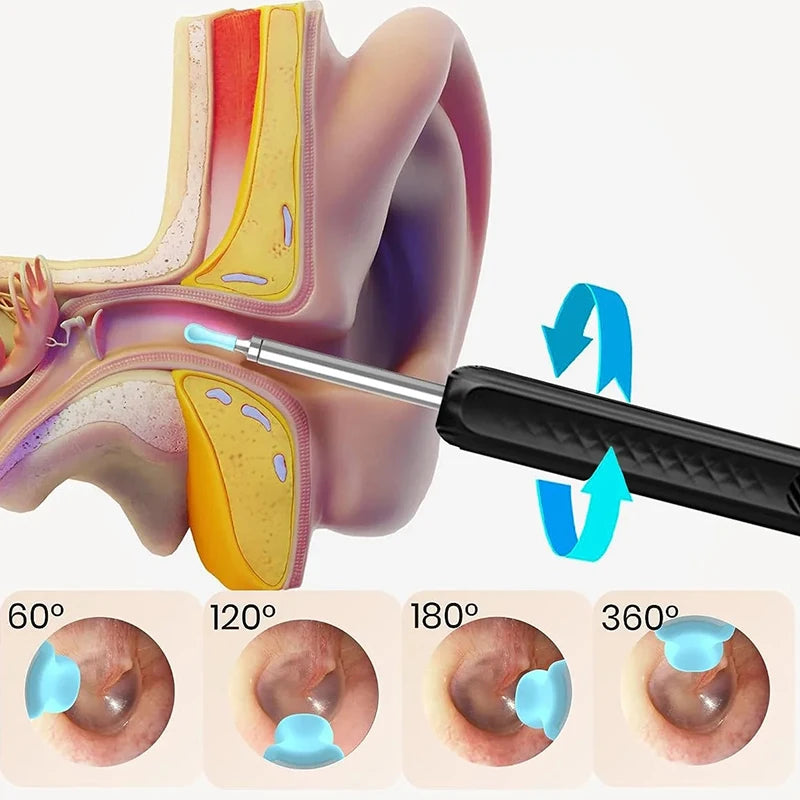 Wireless WiFi Ear Pick Otoscope Camera – Luminous Ear Wax Cleaner & Oral Inspection Health Care Kit