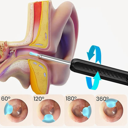 Wireless WiFi Ear Pick Otoscope Camera – Luminous Ear Wax Cleaner & Oral Inspection Health Care Kit