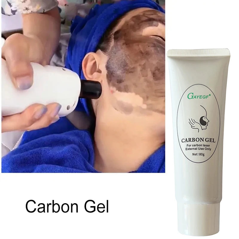 Carbon Cream Black Gel for ND YAG Laser – Skin Peeling, Rejuvenation, Whitening & Deep Cleansing Face Cream