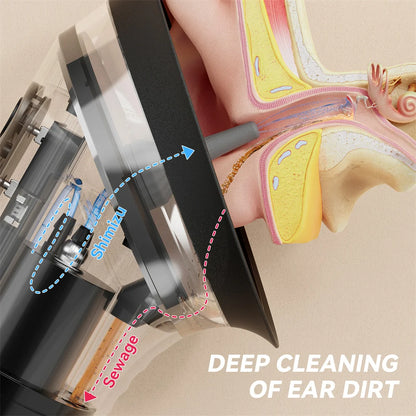 Electric Ear Wax Removal System – Water Powered Ear Cleaner with Irrigation Flusher, 3 Pressure Settings for Safe & Effective Ear Care Tool
