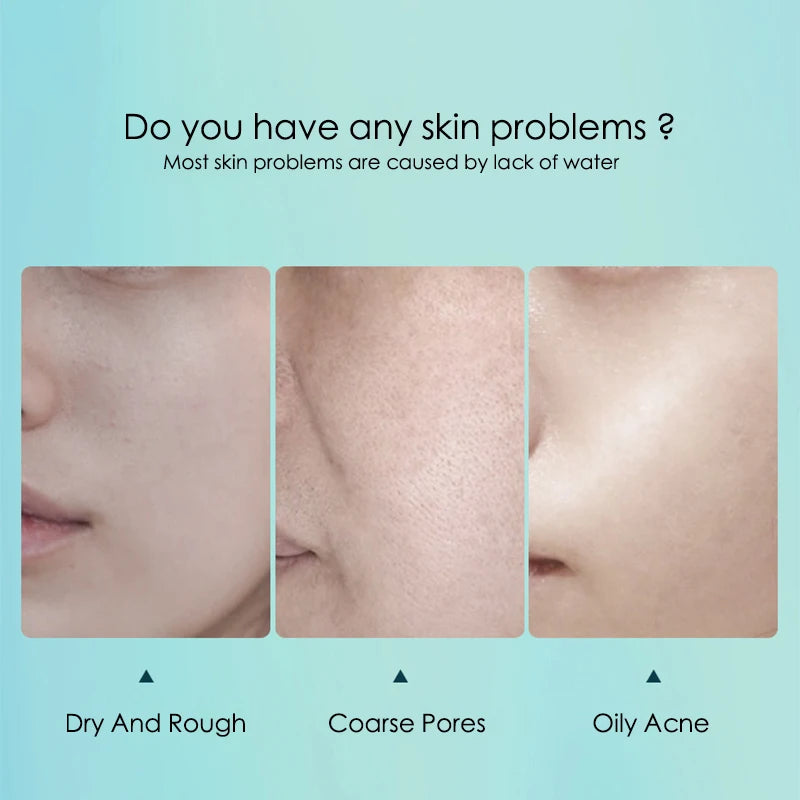 10pcs Hyaluronic Acid Hydrating Facial Mask – Moisturizing, Pore Shrinking Skin Care Face Masks
