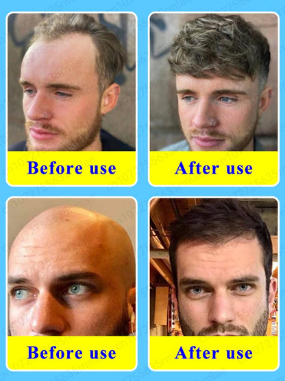 Rapid Hair Growth Serum – Beard, Chest & Body Hair Enhancer for Fuller, Thicker Growth