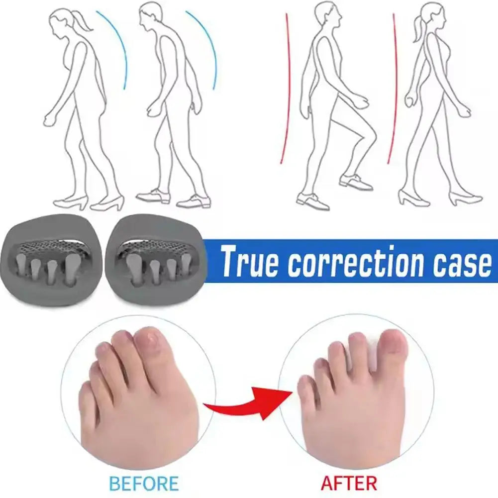 Arch Support Correction Slippers - Foot Alignment and Gait Support Shoes for Men and Women