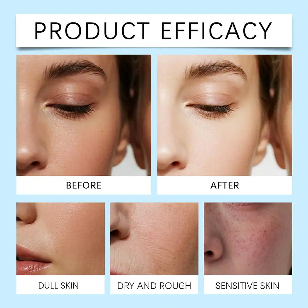 90ml Niacinamide Face Serum - Brightening & Deep Hydration with Hyaluronic Acid and Vitamin E