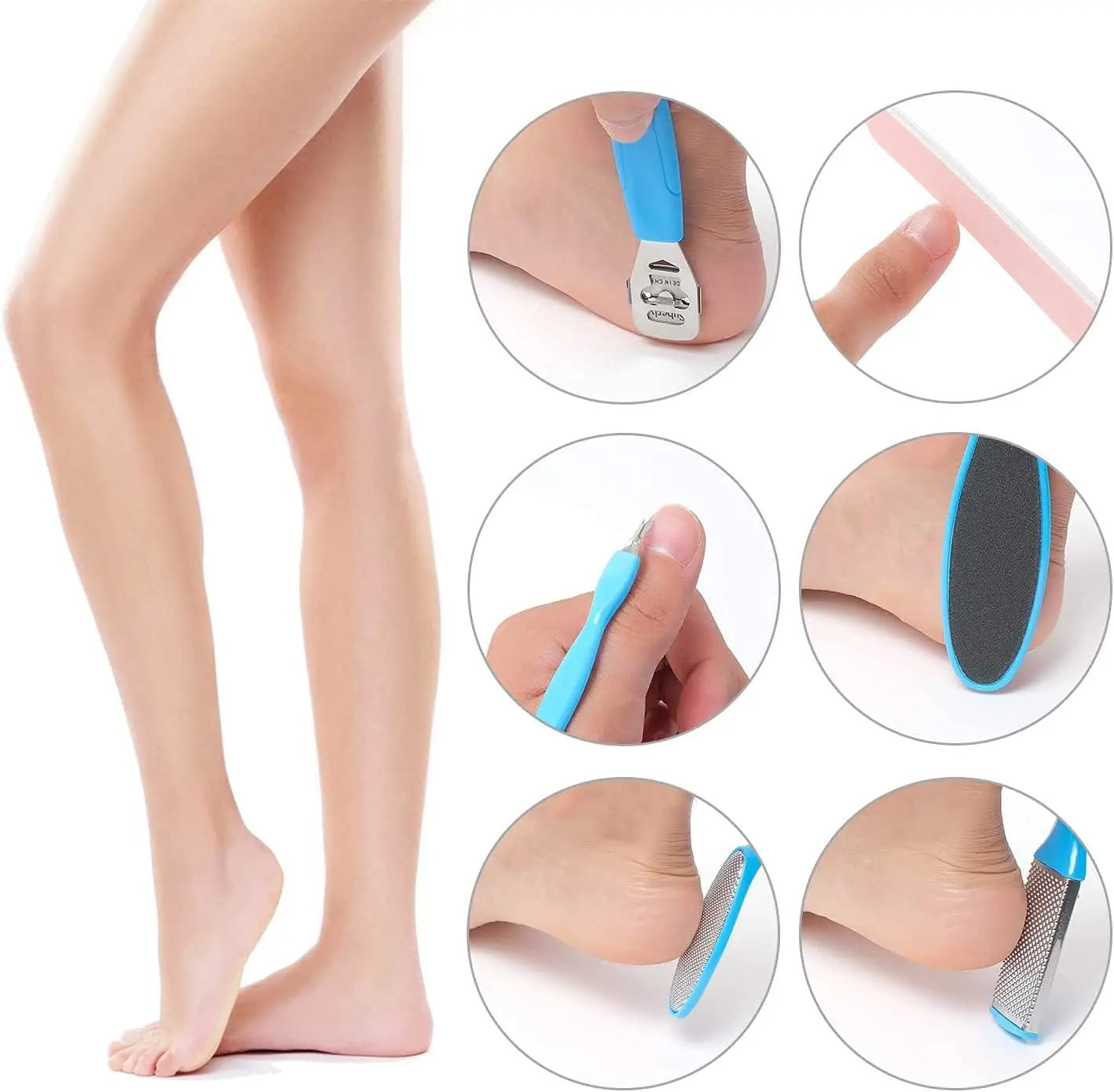 8 Piece Foot Exfoliating File Set - Octopus Fish Eye Heel Scraper for Callus Removal, Cracked Heel and Sole Care