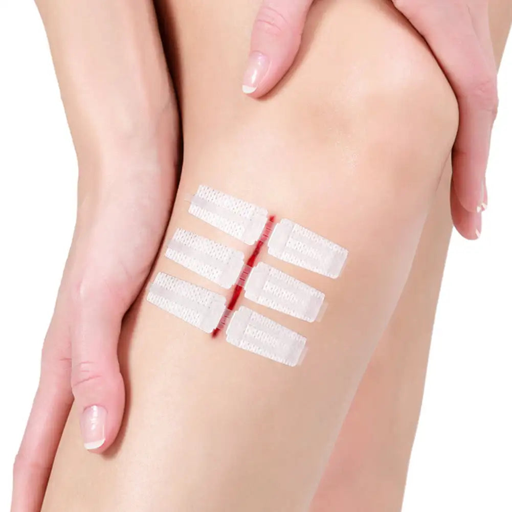 Emergency Wound Closure Strips - Zipper-Style Suture-Free Laceration Closure Device for First Aid