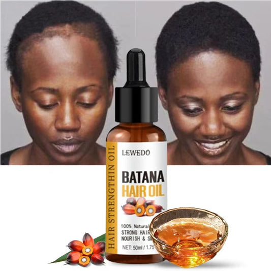 Lewedo Naturals Batana Oil - Pure Hair Care Treatment for Men & Women Nourishing Shiny Hair & Scalp Support