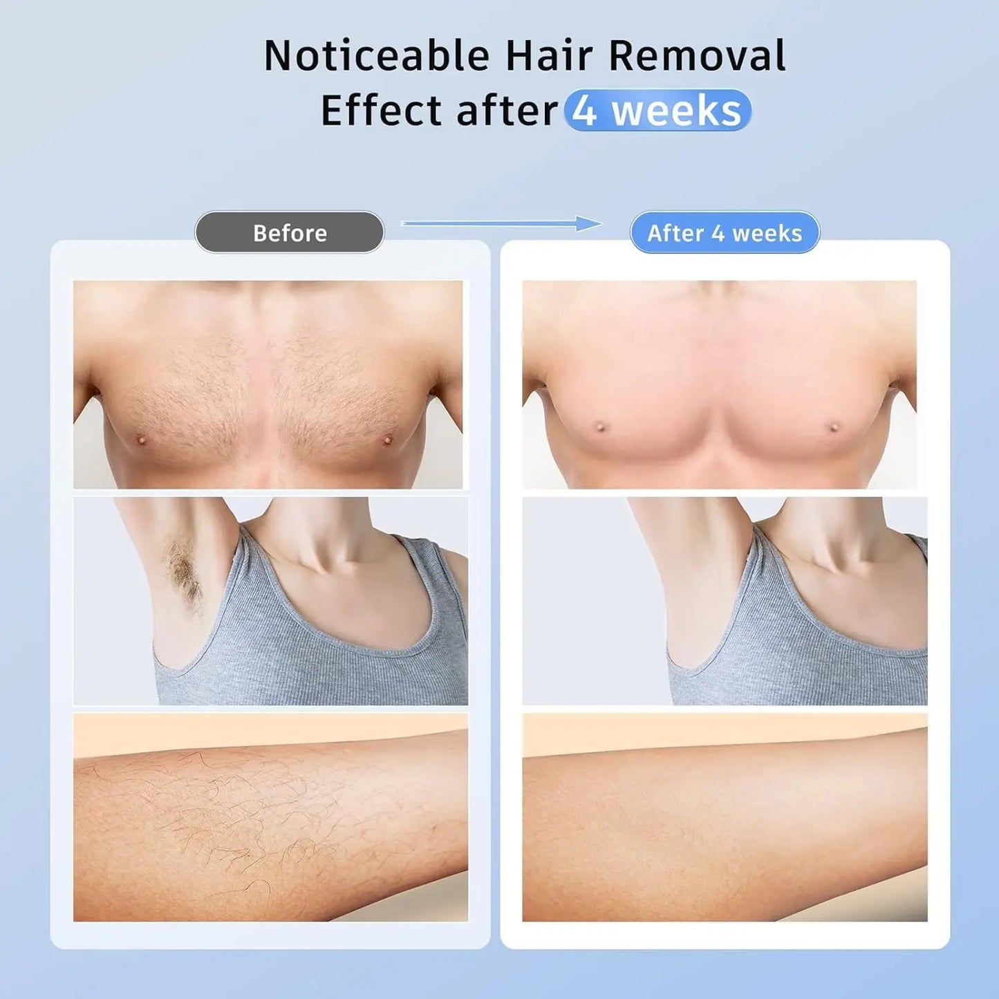3-in-1 IPL Laser Hair Removal Device with Ice Cooling – Painless At-Home Hair Remover for Women & Men
