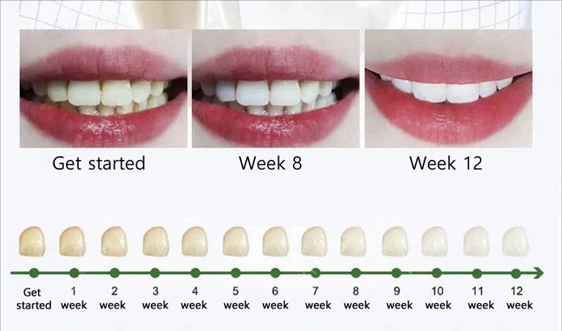 Cavity Removal & Gum Repair Oral Care – Clears Oral Bacteria for Healthy Gums