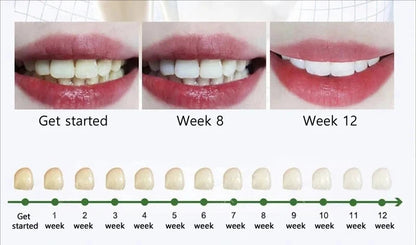 Cavity Removal & Gum Repair Oral Care – Clears Oral Bacteria for Healthy Gums