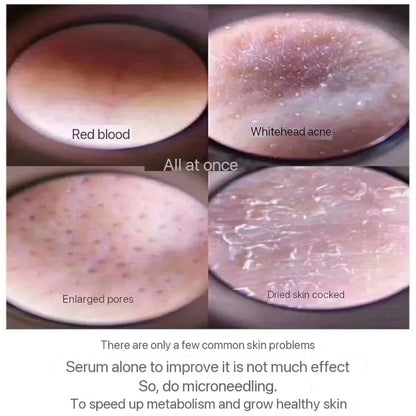 10pcs Sponge Microcrystal Freeze-Dried Powder Collagen Regeneration Sponges – Natural Biological Extract for Skin Cell Renewal