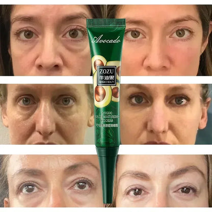 7-Day Tighten Wrinkles Eye Cream: Anti Dark Circles, Bags, Puffiness - Fades Fine Lines, Whitens Under Eye Skin - Korean Care Innovation