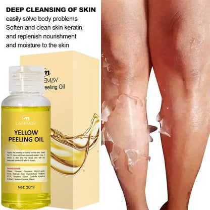 Yellow Peeling Oil – Skin Lightening & Melanin Treatment for Elbows, Knees, Hands, and Even Skin Tone