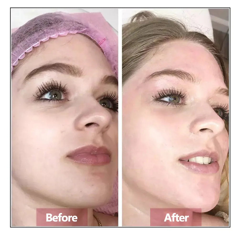 Hyaluronic Acid Face Serum – Hydrating, Moisturizing & Anti-Aging Skin Repair Essence