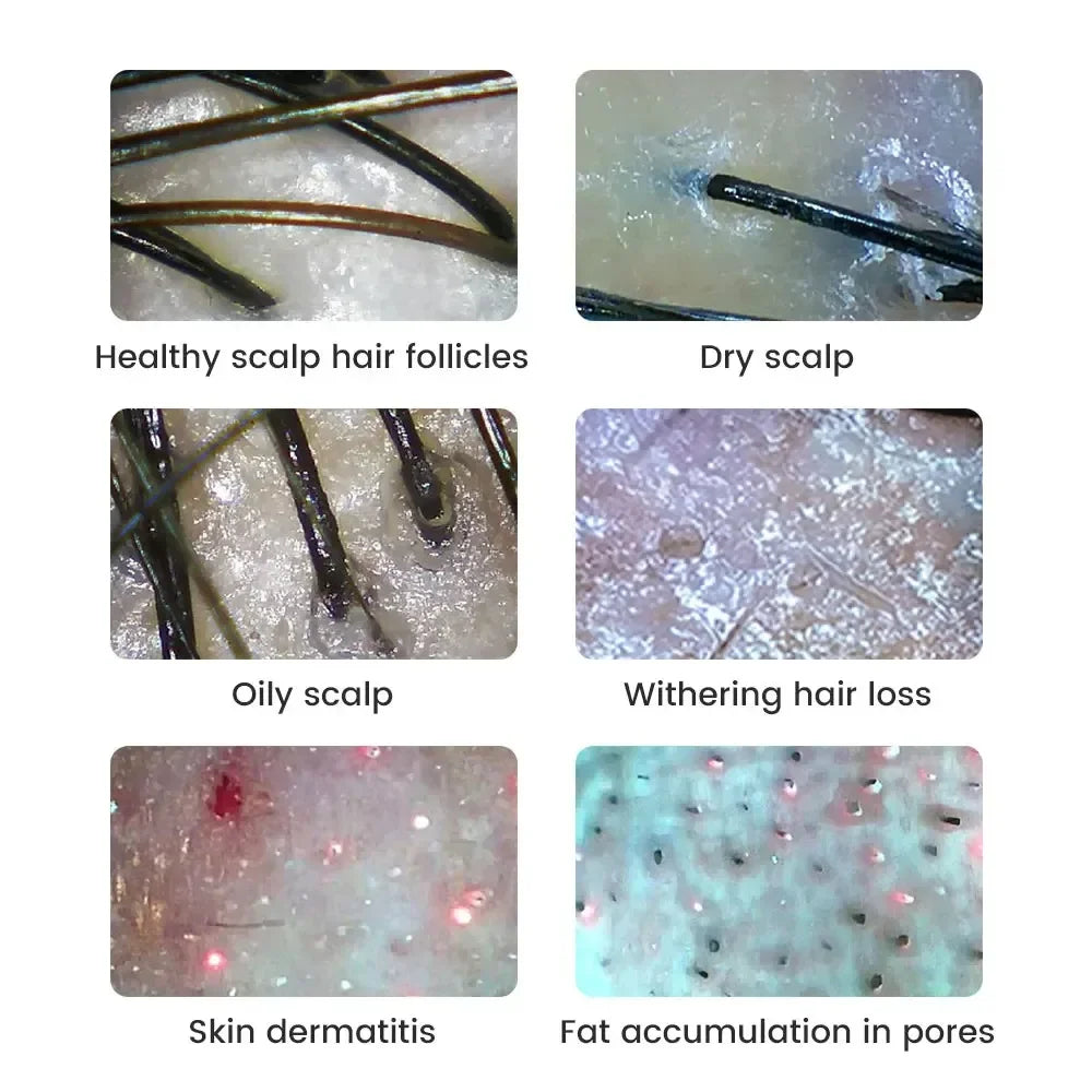 Portable 1000x Digital WiFi Wireless Microscope & Skin Scalp Analyzer for Mobile Phone Connection