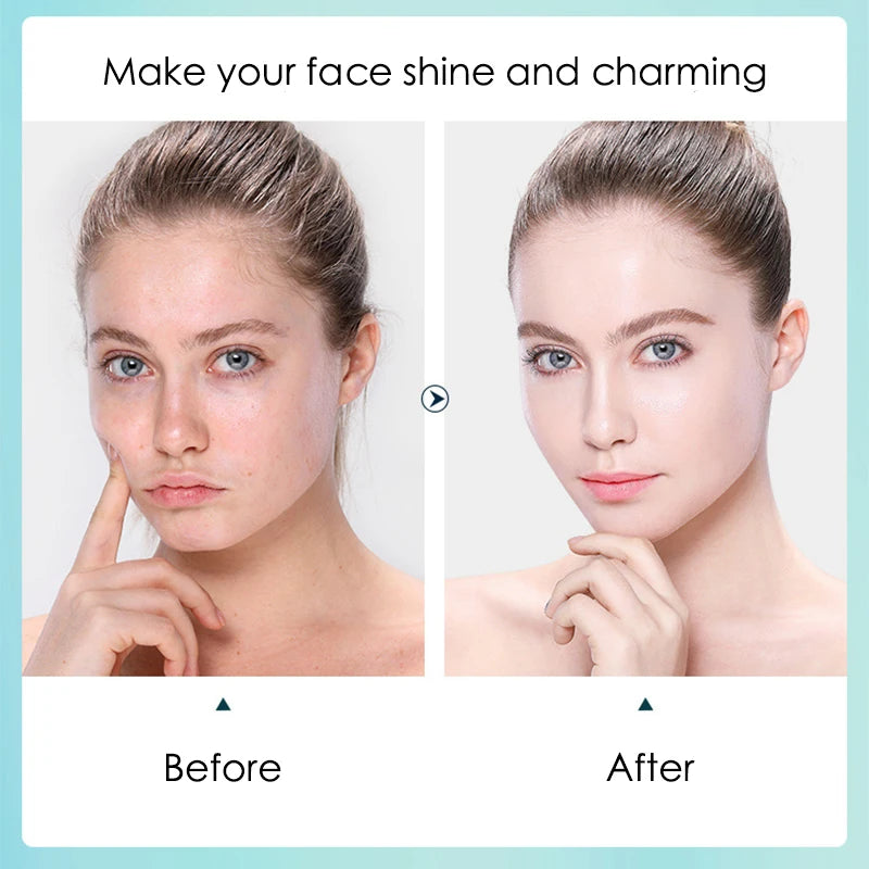 10pcs Hyaluronic Acid Hydrating Facial Mask – Moisturizing, Pore Shrinking Skin Care Face Masks