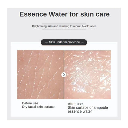 500ml Hyaluronic Acid Facial Essence – Moisturizing, Whitening, Pore Minimizing, Anti-Aging & Anti-Wrinkle Serum with VC & Niacinamide