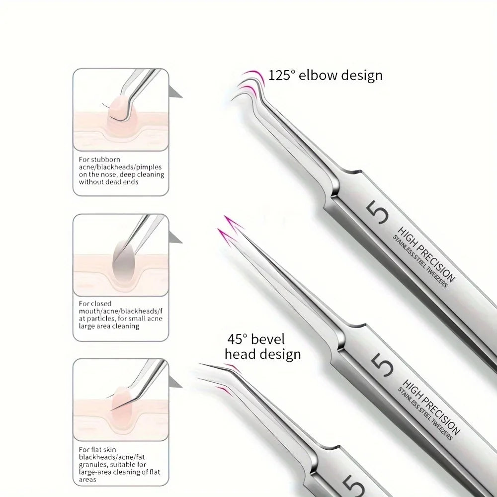 1/3/8PCS Stainless Steel Blackhead Removal Tool Set – Facial Tweezers, Acne Needles & Beauty Blackhead Removers