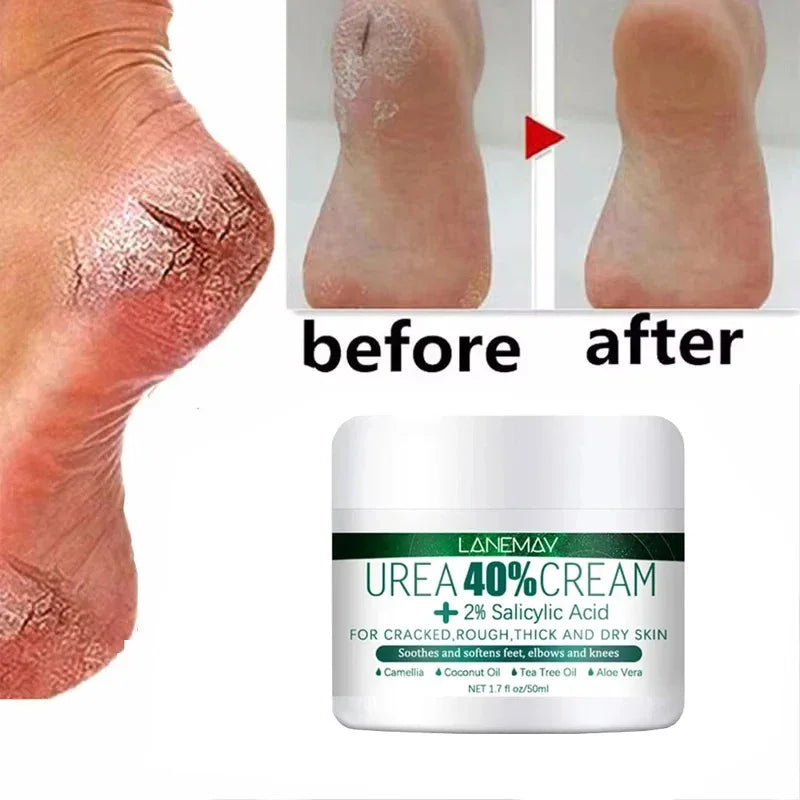 Herbal Heel Repair Foot Cream – Cracked Heel Care, Dead Skin Exfoliation & Deep Moisturizing for Soft, Smooth Feet