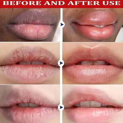 Dark Lip Balm Lightening Treatment – Exfoliating Melanin Mask for Pinker Lips, Reduces Lines & Improves Dryness
