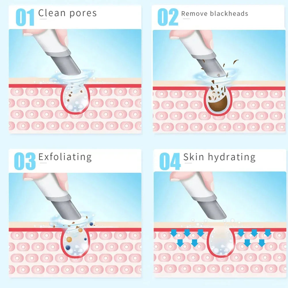 New Peeling Beauty Device – Small Bubble Oxygen Injection Hydra Dermabrasion Aqua Facial Cleaner for Blackhead Removal