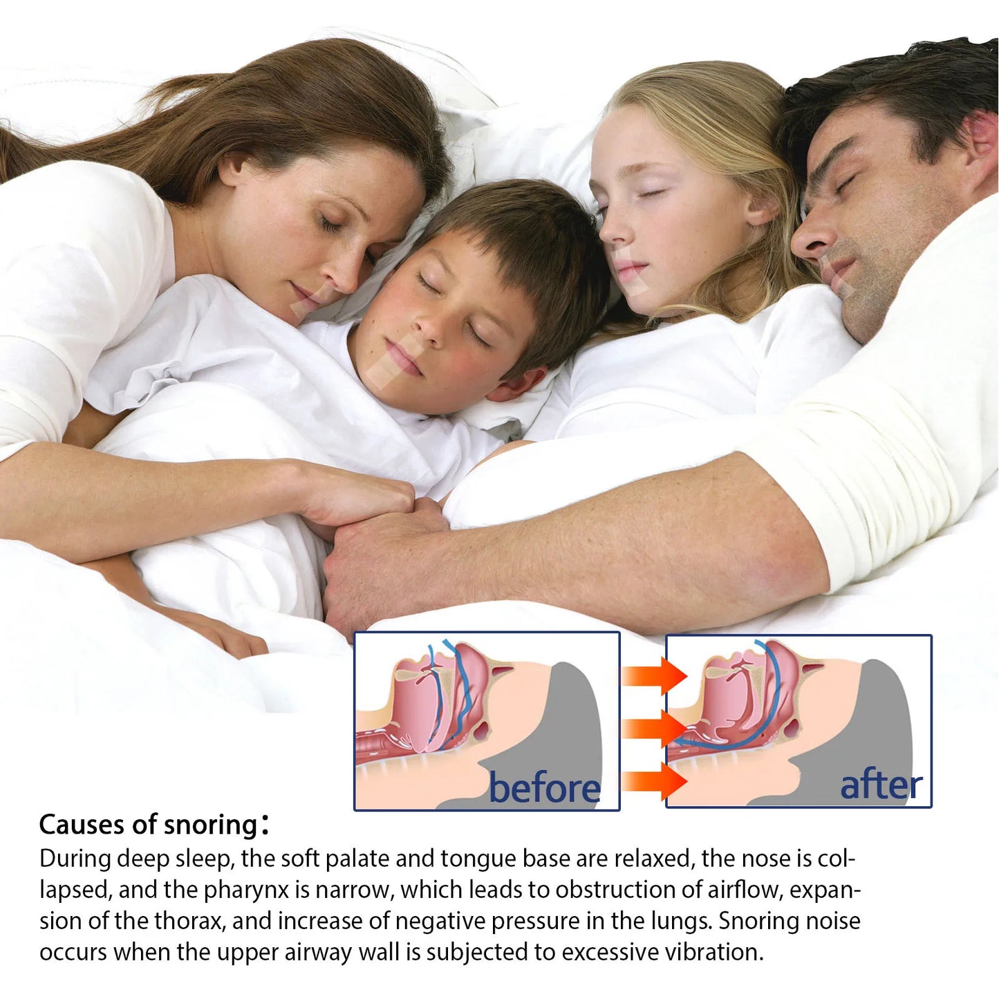 Mouth Tape Adhesive – Hypoallergenic Sleep Aid for Nose Breathing, Gentle Physical Sleep Mouth Tape 9M