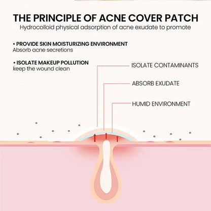 Acne Repair Patch - Facial Skin Care for Blemish & Pimple Marks, Acne Treatment & Pimple Repair Cover