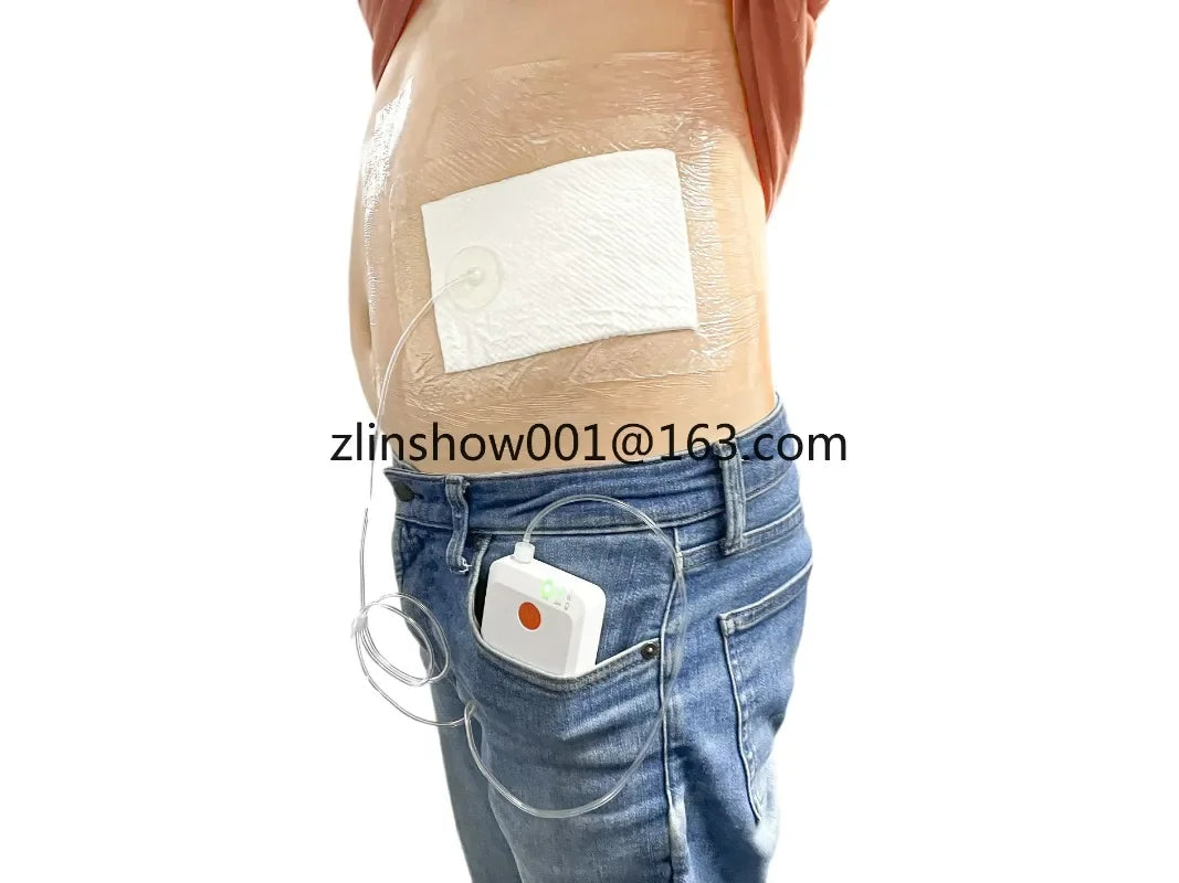 Negative Pressure Wound Therapy (NPWT) System — VAC Device with Dressing Kit for Medical Wound Care