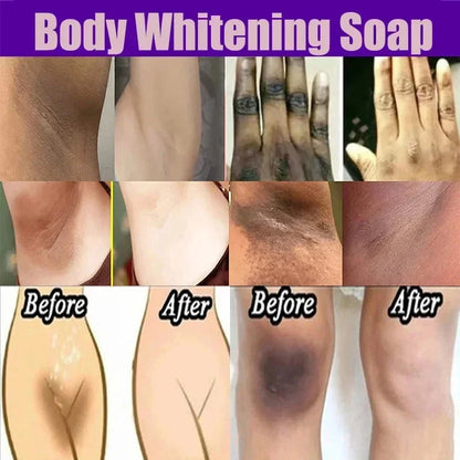 Body Whitening Soap – Underarm & Knee Bleaching, Dark Spot Removal, Chicken Skin Treatment, Dead Skin Exfoliating & Moisturizing