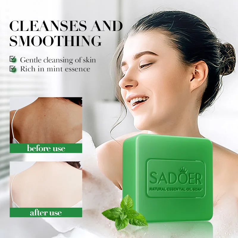 Peppermint Essential Oil Handmade Soap – Kojic Acid & Turmeric Brightening Body & Hand Cleansing Bar for Skin Whitening Care
