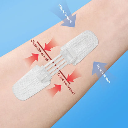 Zipper Wound Closure Patches - Painless Suture-Free Dressing for First Aid and Outdoor Use