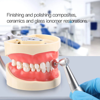 Dental Finishing & Polishing Discs – Superfine, Fine, Medium, Coarse for Composites, Ceramics & Glass Ionomer