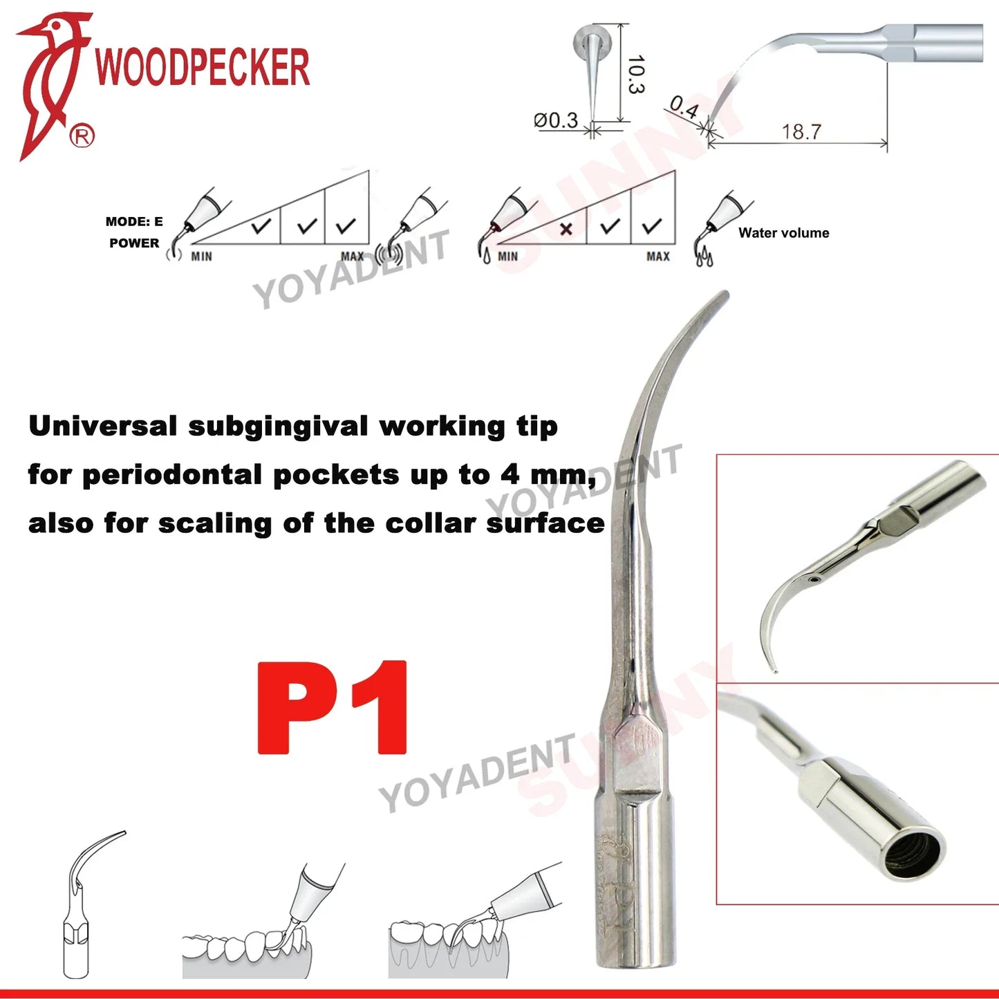 Woodpecker Dental Scaler Tips – Ultrasonic Tooth Cleaning, Endo & Perio Scaling Tips, Fit EMS UDS Scaler Handpiece