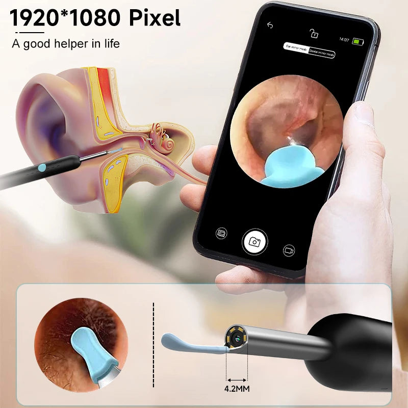 WiFi Visual Ear Sticks – HD 1080P 4.2MM Mini Otoscope Camera, Wireless Ear Picker & Cleaner, Endoscope for Ear Wax Removal & Health Care