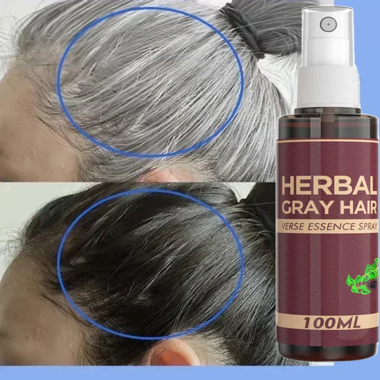 White Hair Killer – Gray Hair Remover & Natural Hair Color Restorer in 7 Days