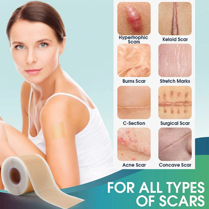 Medical-Grade Silicone Scar Sheets Roll - Reusable Treatment for Keloid, C-Section, Surgery & Burns - Professional Scar Care Solution