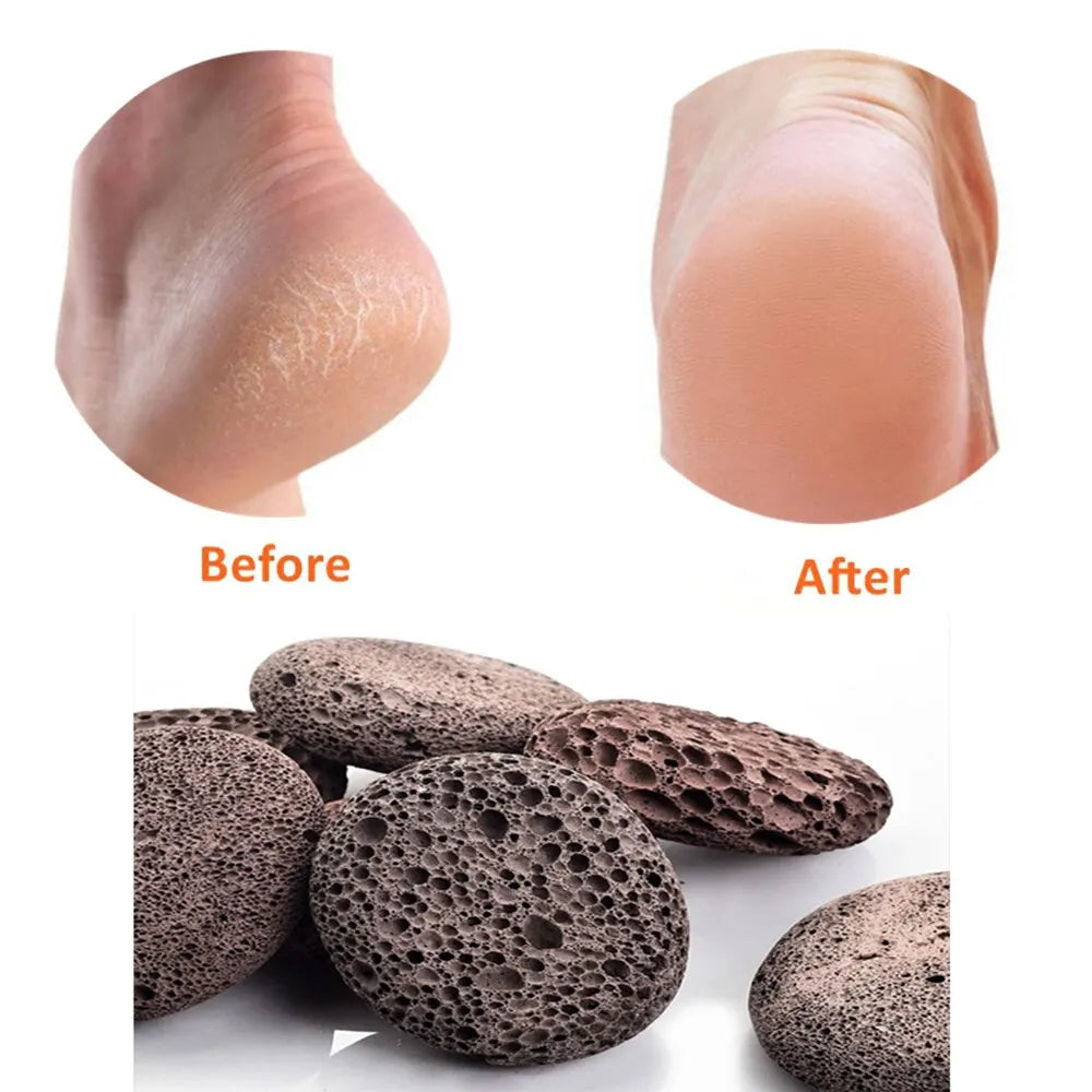 Natural Pumice Stone Foot Scrubber - Pedicure Exfoliation Tool for Removing Calluses and Smoothing Heels, Hands, and Body