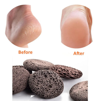Natural Pumice Stone Foot Scrubber - Pedicure Exfoliation Tool for Removing Calluses and Smoothing Heels, Hands, and Body