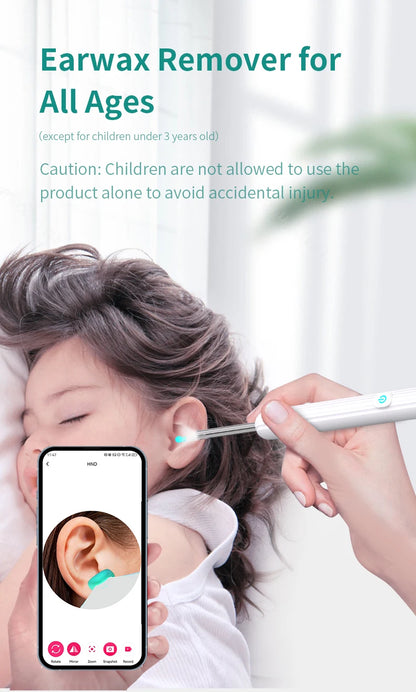 Smart Visual Ear Cleaner 1296P with Camera – USB-C Rechargeable Ear Wax Removal Tool, WiFi, 6 LED Lights