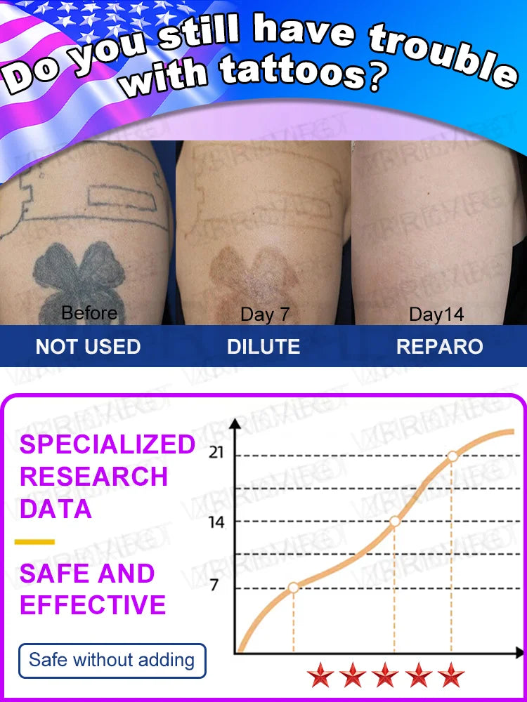Laser Tattoo Removal Pen – Effective Portable Tattoo Eraser